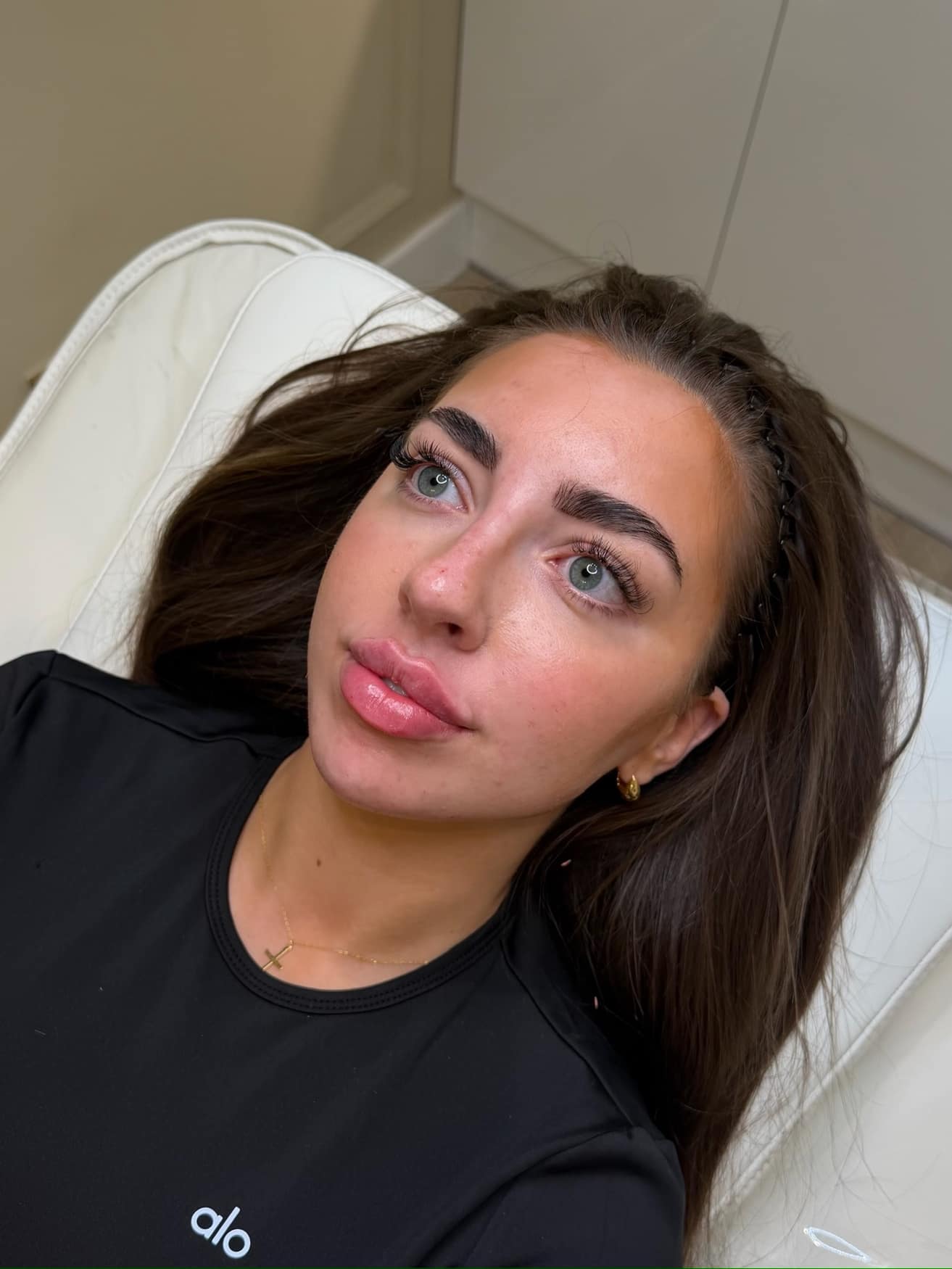 A Face by Demi client with balanced, sculpted features