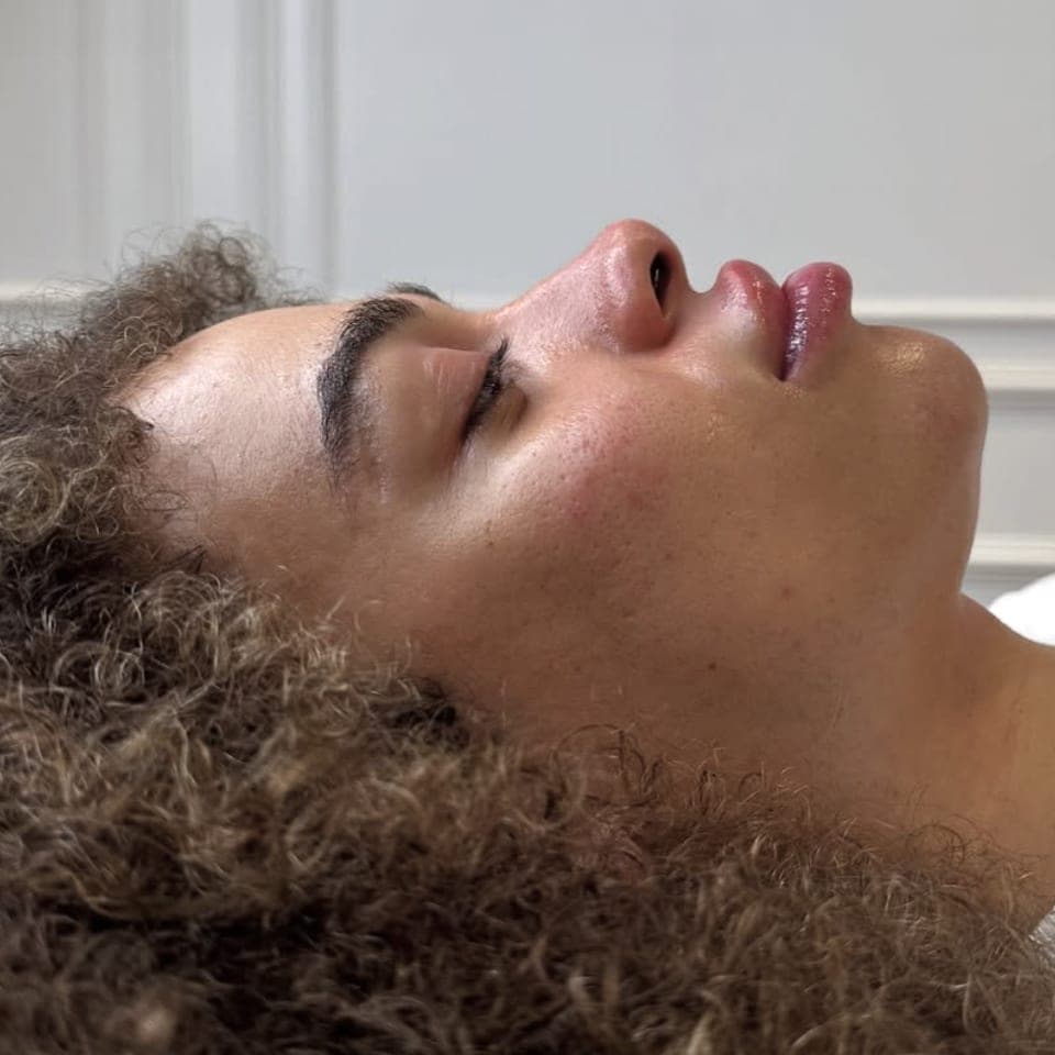 Non-surgical rhinoplasty at Face by Demi, before and after